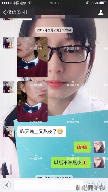 臉上長痘痘怎么去掉？徹底告別痘痘，自卑到自信的蛻變！