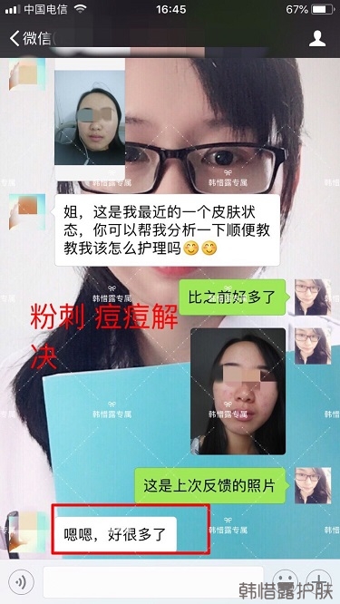 額頭長痘臉頰長痘痘粉刺，這樣調理幫你恢復嫩白肌膚！