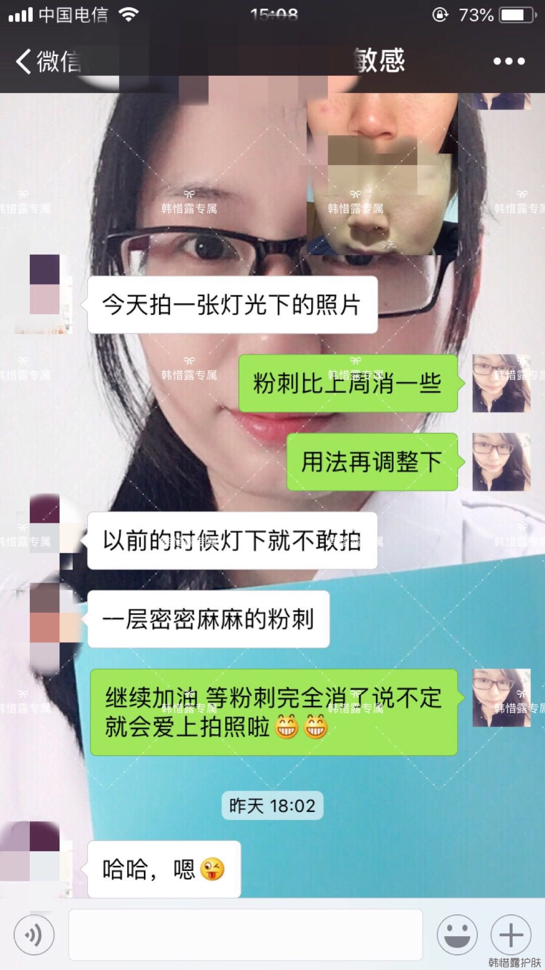 粉刺痘痘怎么有效去除？以前不敢拍燈光下照片，粉刺少了，現(xiàn)在敢了！