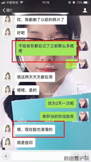 膿包痘祛痘效果，擁有干凈的臉不等待！