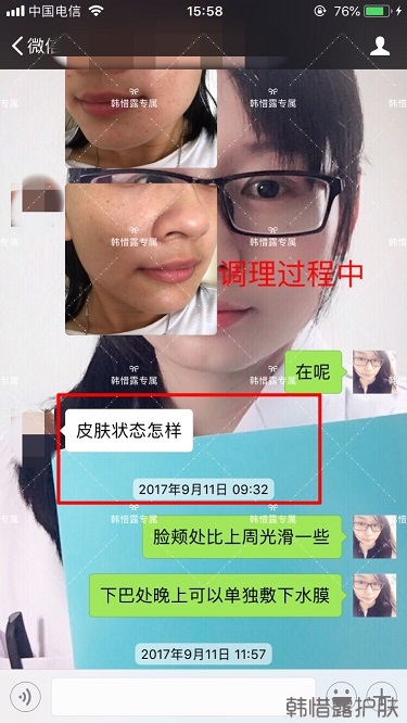 粉刺密密麻麻，試過(guò)很多方法無(wú)果后找韓惜露老師輕松去掉粉刺！