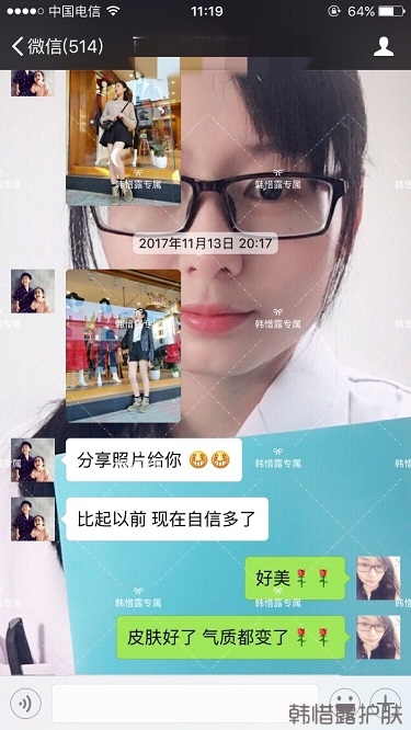 臉上長痘痘怎么去掉？徹底告別痘痘，自卑到自信的蛻變！