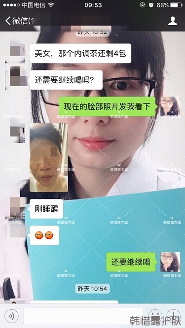 膿包結節發硬痘痘全消了，帥哥開心的來反饋了！