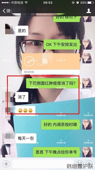 膿包結節發硬痘痘全消了，帥哥開心的來反饋了！