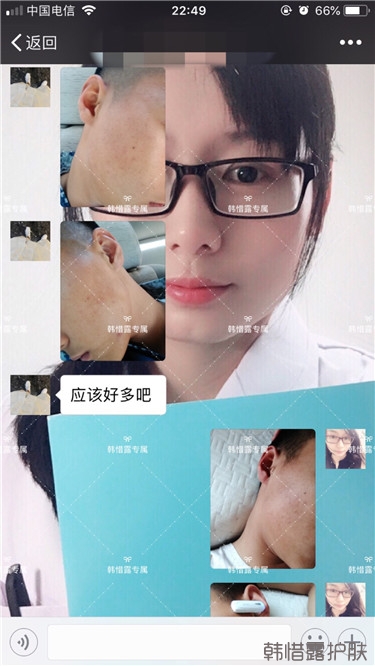 粉刺消了，皮膚光滑了，變帥氣不少呦！