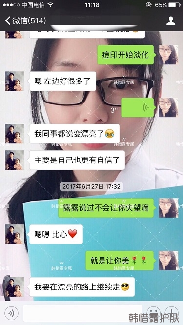臉上長痘痘怎么去掉？徹底告別痘痘，自卑到自信的蛻變！
