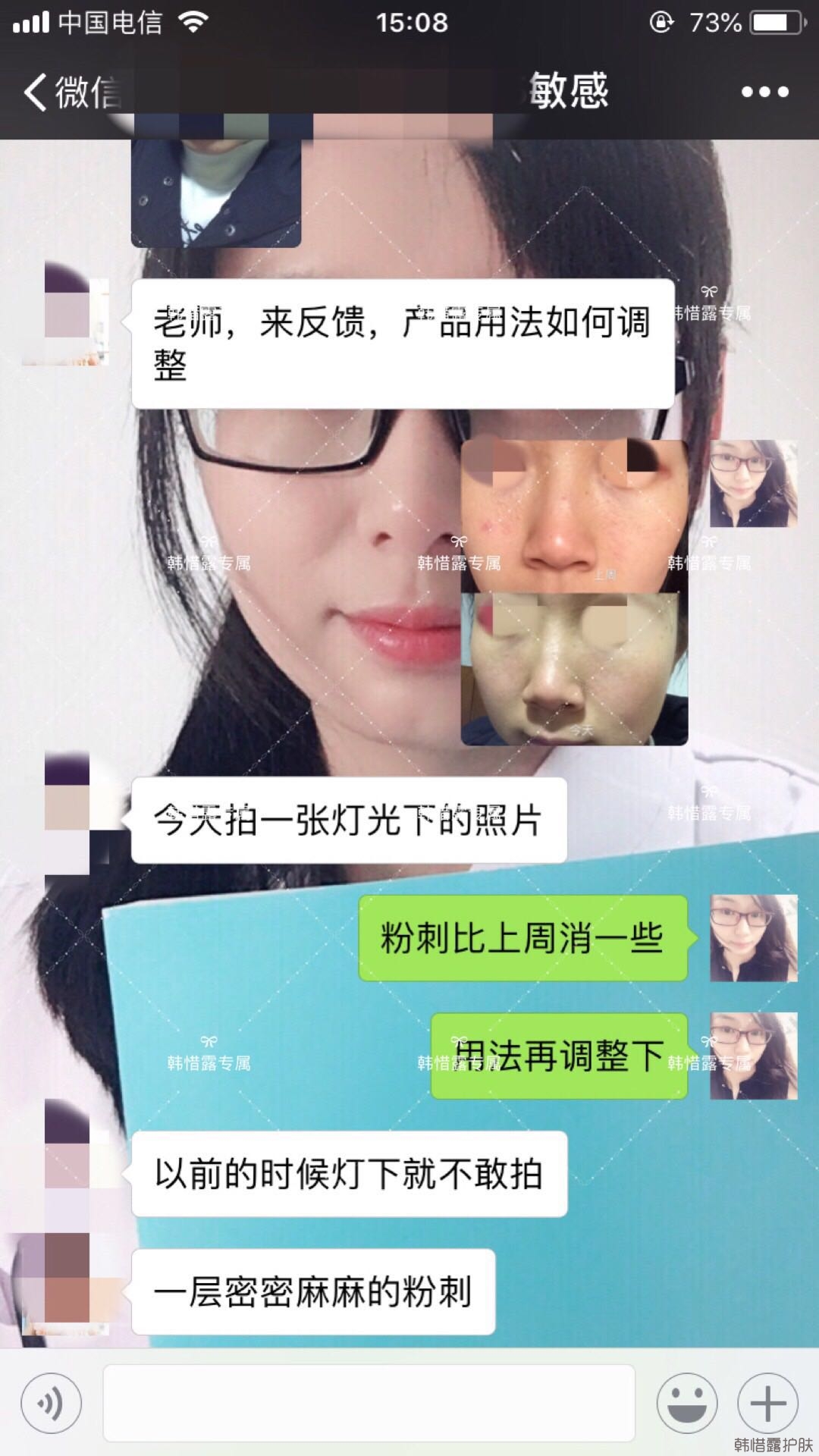 粉刺痘痘怎么有效去除？以前不敢拍燈光下照片，粉刺少了，現(xiàn)在敢了！