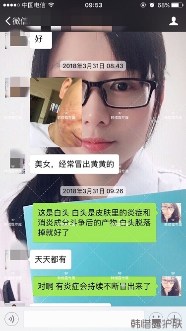 膿包結節發硬痘痘全消了，帥哥開心的來反饋了！