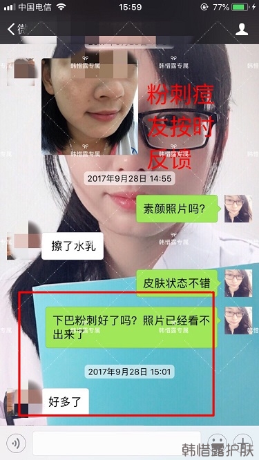 粉刺密密麻麻，試過(guò)很多方法無(wú)果后找韓惜露老師輕松去掉粉刺！