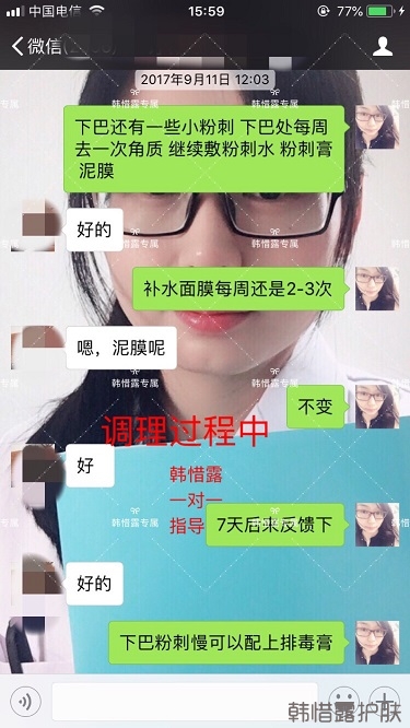 粉刺密密麻麻，試過(guò)很多方法無(wú)果后找韓惜露老師輕松去掉粉刺！